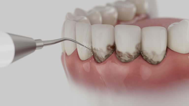 Reliable Dental Crowns And Bridges contractor in Oliver County County, ND by Dentist Open Now